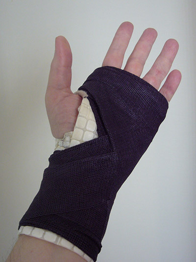 Hand in cast